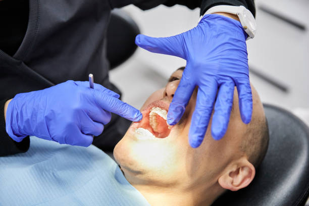 Best Emergency Dentist for Lost Fillings or Crowns in San Diego, CA